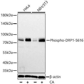 Phospho-DNM1L (Ser616) Antibody in Western Blot (WB)