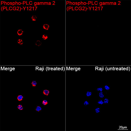 Phospho-PLCG2 (Tyr1217) Antibody in Immunocytochemistry (ICC/IF)