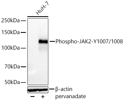 Phospho-JAK2 (Tyr1007, Tyr1008) Antibody in Western Blot (WB)