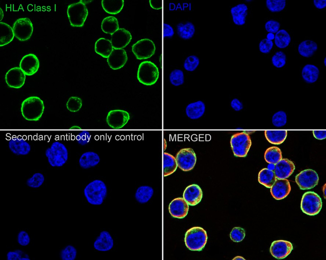 HLA Class I Antibody in Immunocytochemistry (ICC/IF)
