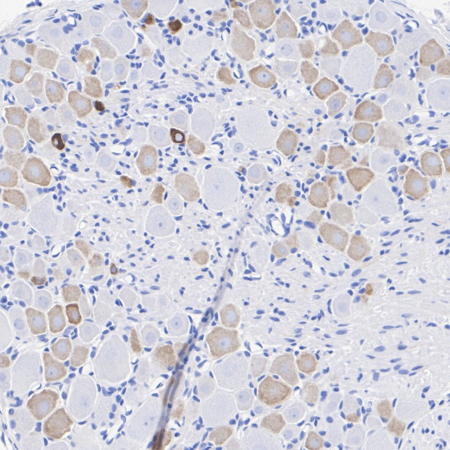 TRPV1 Antibody in Immunohistochemistry (Paraffin) (IHC (P))