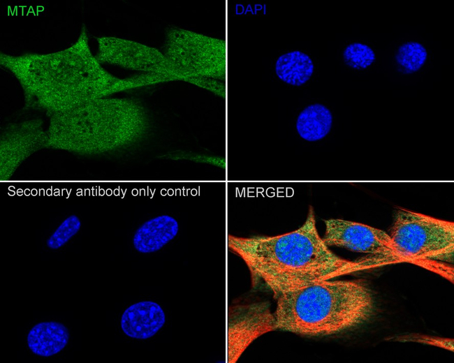 MTAP Antibody in Immunocytochemistry (ICC/IF)