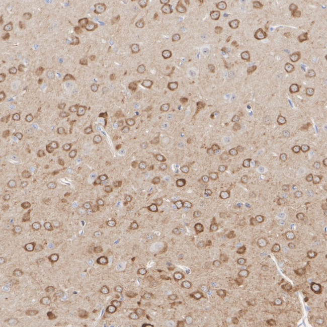 IP3 Receptor 1 Antibody in Immunohistochemistry (Paraffin) (IHC (P))