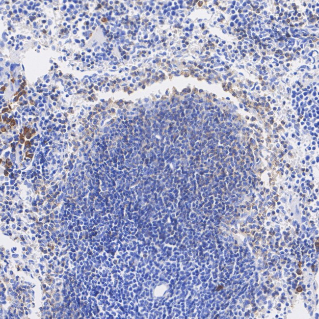 CD25 Antibody in Immunohistochemistry (Paraffin) (IHC (P))