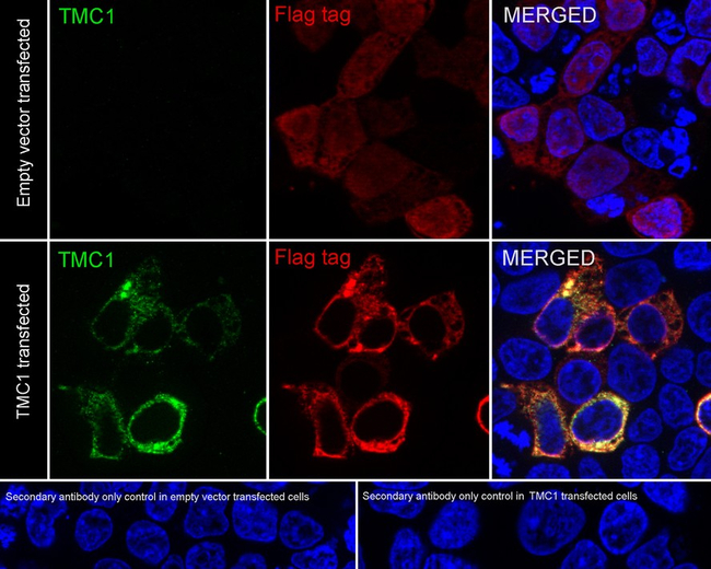 TMC1 Antibody in Immunocytochemistry (ICC/IF)