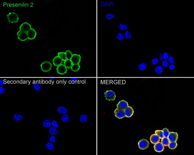 PSEN2 Antibody in Immunocytochemistry (ICC/IF)