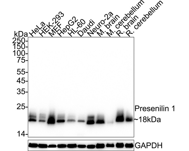 Presenilin 1 Antibody in Western Blot (WB)
