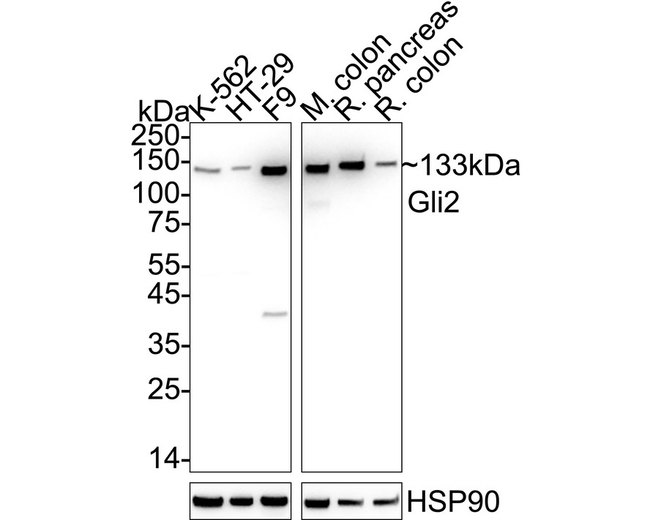 GLI2 Antibody in Western Blot (WB)
