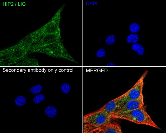 HIP2 Antibody in Immunocytochemistry (ICC/IF)