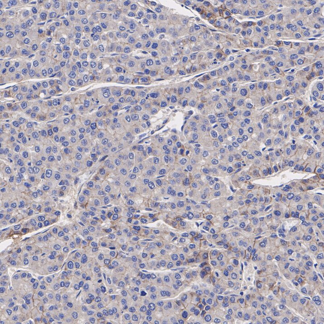 SMOC2 Antibody in Immunohistochemistry (Paraffin) (IHC (P))