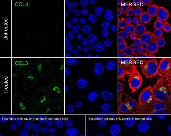 CCL3 Antibody in Immunocytochemistry (ICC/IF)