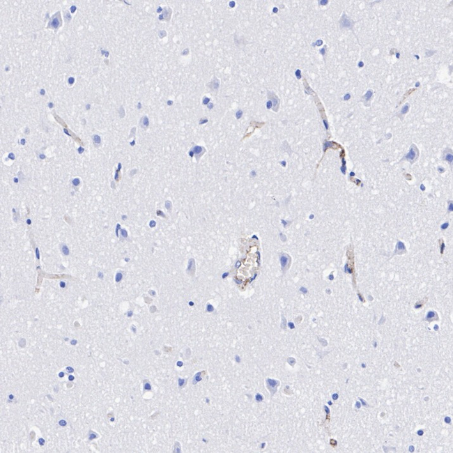 LPA Antibody in Immunohistochemistry (Paraffin) (IHC (P))