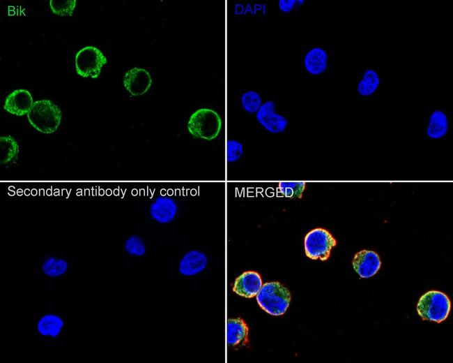 BIK Antibody in Immunocytochemistry (ICC/IF)