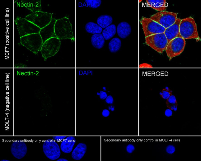 Nectin 2 Antibody in Immunocytochemistry (ICC/IF)