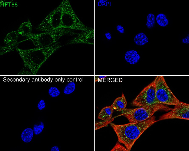 IFT88 Antibody in Immunocytochemistry (ICC/IF)