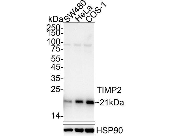 TIMP2 Antibody in Western Blot (WB)