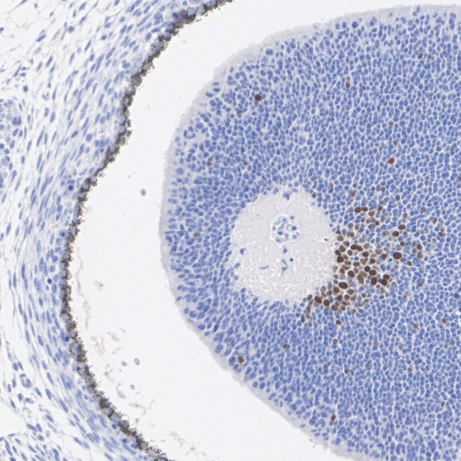 POU4F1 Antibody in Immunohistochemistry (Paraffin) (IHC (P))