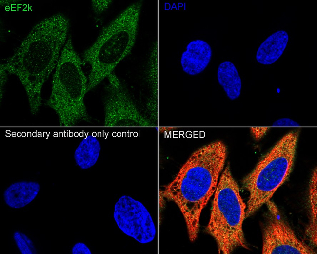 EEF2K Antibody in Immunocytochemistry (ICC/IF)