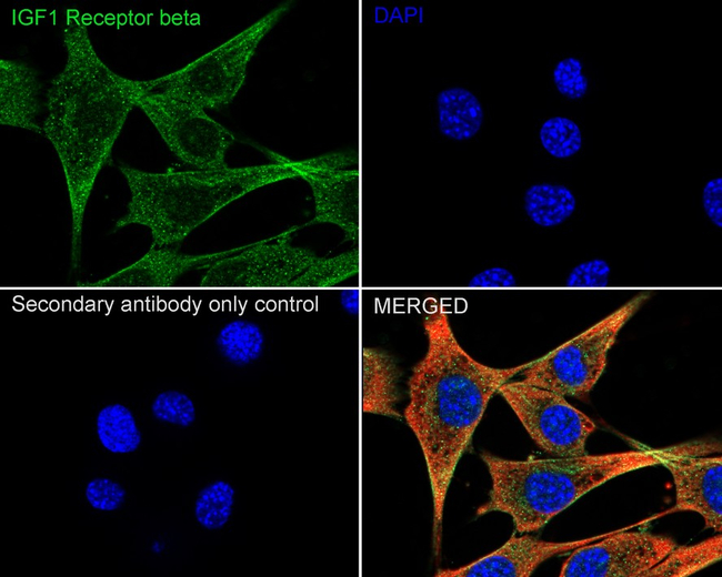 IGF1R beta Antibody in Immunocytochemistry (ICC/IF)