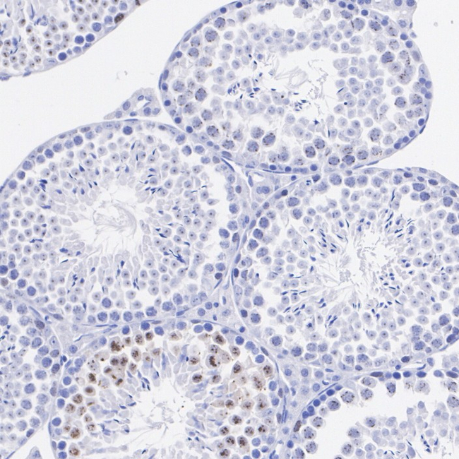 Survivin Antibody in Immunohistochemistry (Paraffin) (IHC (P))