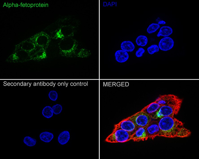 AFP Antibody in Immunocytochemistry (ICC/IF)