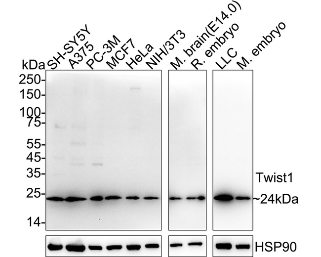 TWIST1 Antibody in Western Blot (WB)