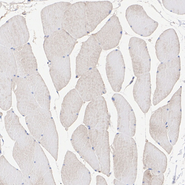 MAP2K4 Antibody in Immunohistochemistry (Paraffin) (IHC (P))