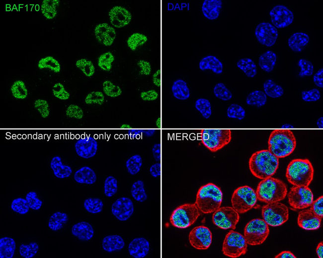 SMARCC2 Antibody in Immunocytochemistry (ICC/IF)