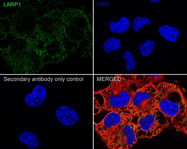 LARP1 Antibody in Immunocytochemistry (ICC/IF)