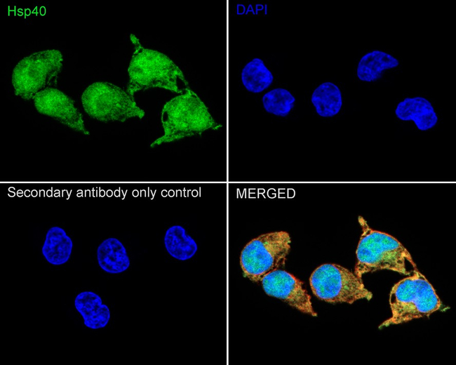 HSP40 Antibody in Immunocytochemistry (ICC/IF)