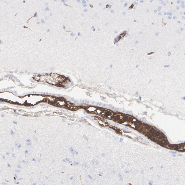 SERPINC1 Antibody in Immunohistochemistry (Paraffin) (IHC (P))