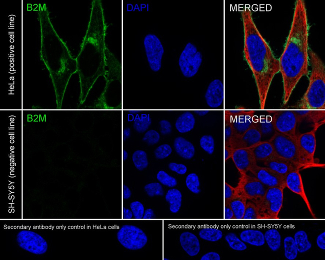beta-2 Microglobulin Antibody in Immunocytochemistry (ICC/IF)