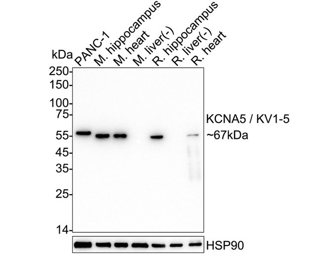 KV1.5 (KCNA5) Antibody in Western Blot (WB)