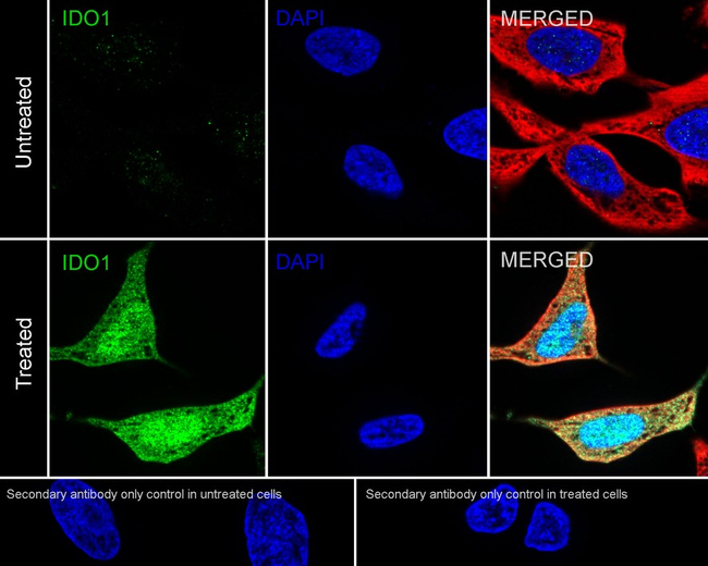 IDO Antibody in Immunocytochemistry (ICC/IF)