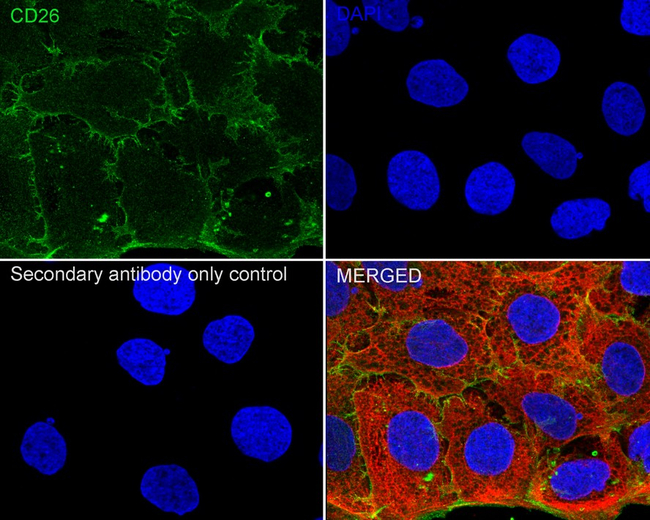 DPP4 Antibody in Immunocytochemistry (ICC/IF)