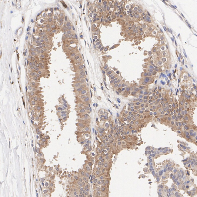 Livin Antibody in Immunohistochemistry (Paraffin) (IHC (P))