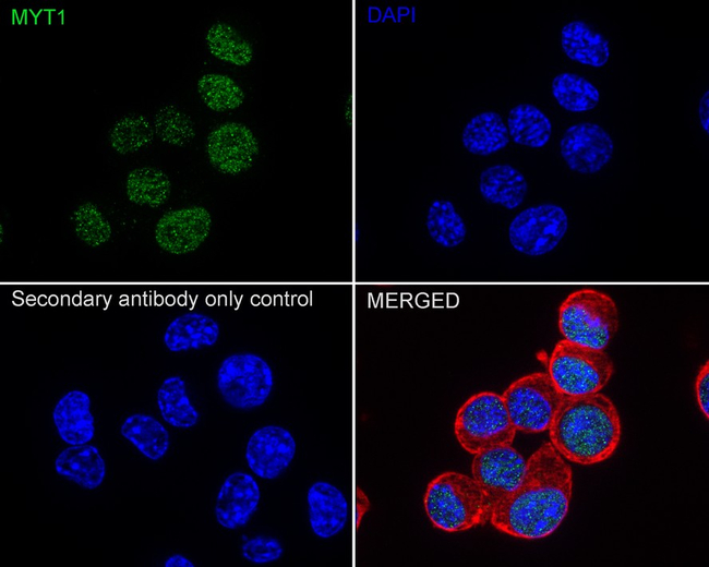 MYT1 Antibody in Immunocytochemistry (ICC/IF)