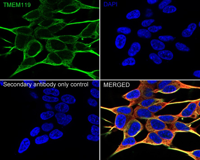 TMEM119 Antibody in Immunocytochemistry (ICC/IF)