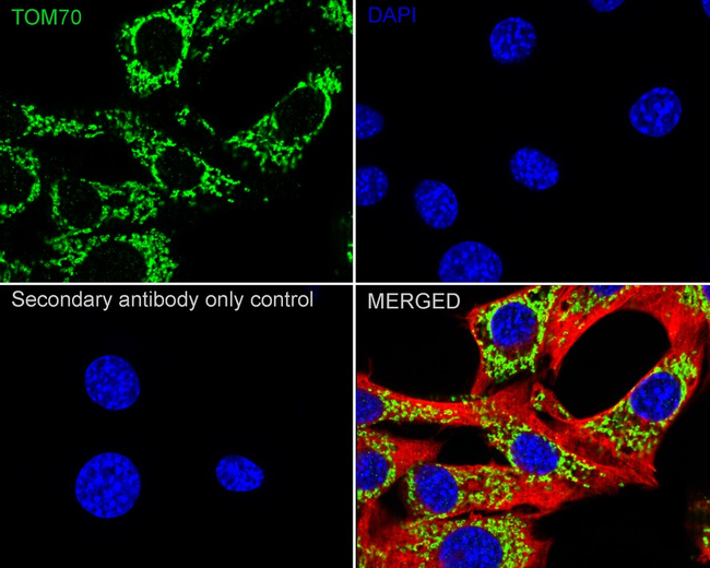 TOM70 Antibody in Immunocytochemistry (ICC/IF)