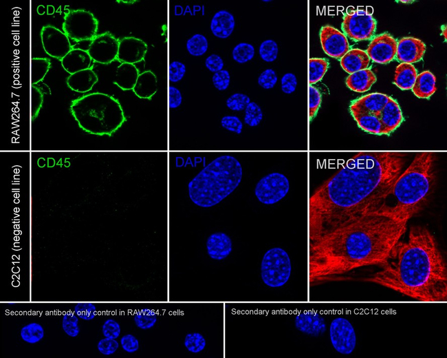 CD45 Antibody in Immunocytochemistry (ICC/IF)