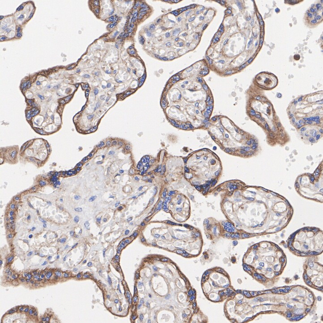 ULBP3 Antibody in Immunohistochemistry (Paraffin) (IHC (P))