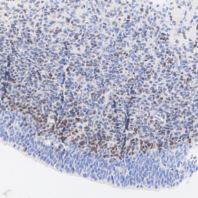 DLX2 Antibody in Immunohistochemistry (Paraffin) (IHC (P))