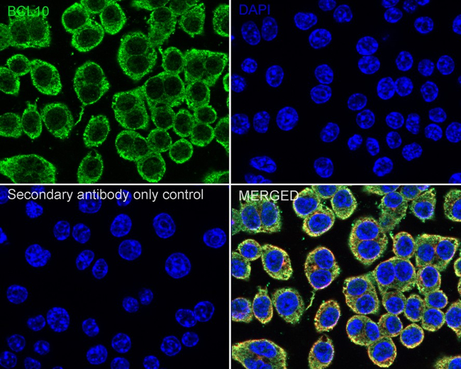 Bcl-10 Antibody in Immunocytochemistry (ICC/IF)
