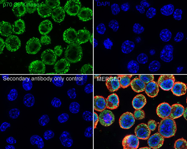 p70 S6 Kinase Antibody in Immunocytochemistry (ICC/IF)