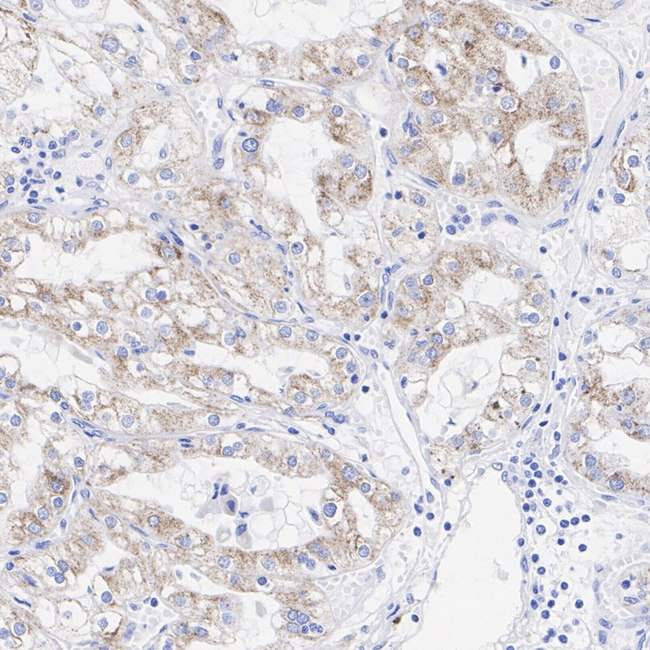 AMACR Antibody in Immunohistochemistry (Paraffin) (IHC (P))