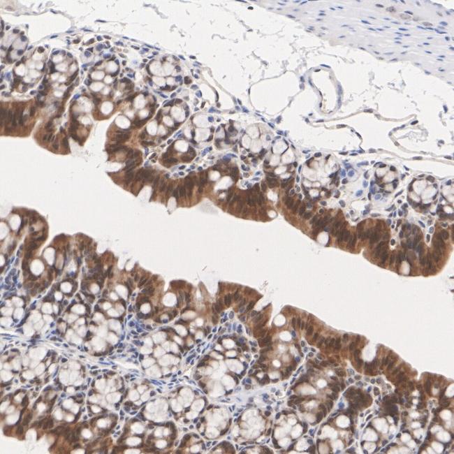 Caspase 7 Antibody in Immunohistochemistry (Paraffin) (IHC (P))