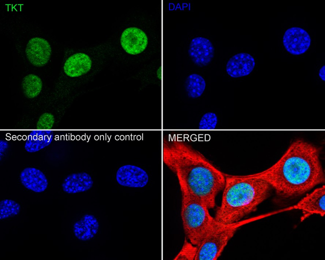 Transketolase Antibody in Immunocytochemistry (ICC/IF)