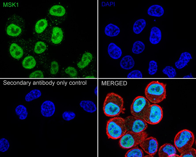 MSK1 Antibody in Immunocytochemistry (ICC/IF)