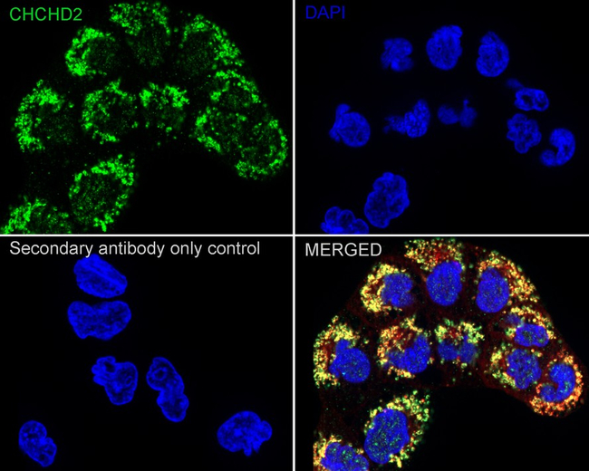 CHCHD2 Antibody in Immunocytochemistry (ICC/IF)