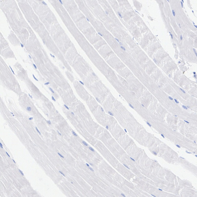 TCF7 Antibody in Immunohistochemistry (Paraffin) (IHC (P))